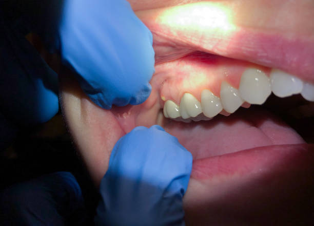 Professional Emergency Dental Service in MI