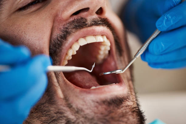 Best Emergency Cosmetic Dentistry (e.g., broken veneers) in Byron Center, MI